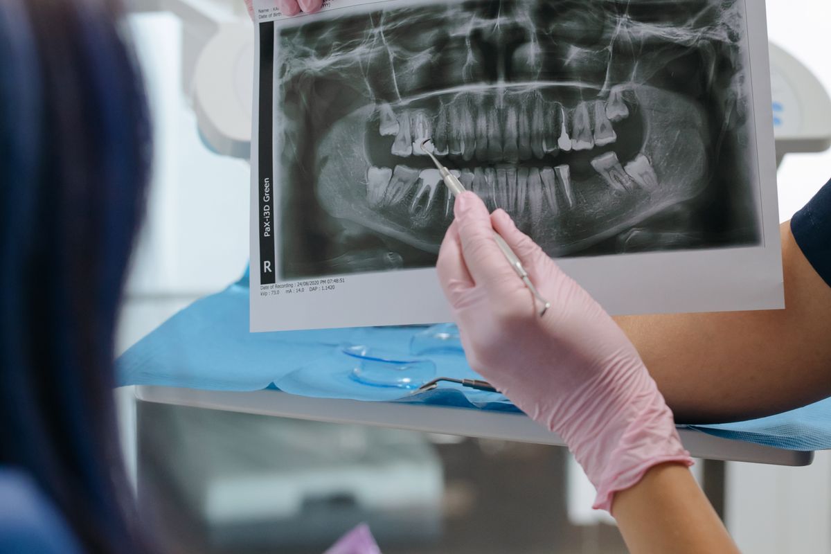 Radiographie dentaire examinée pendant une consultation