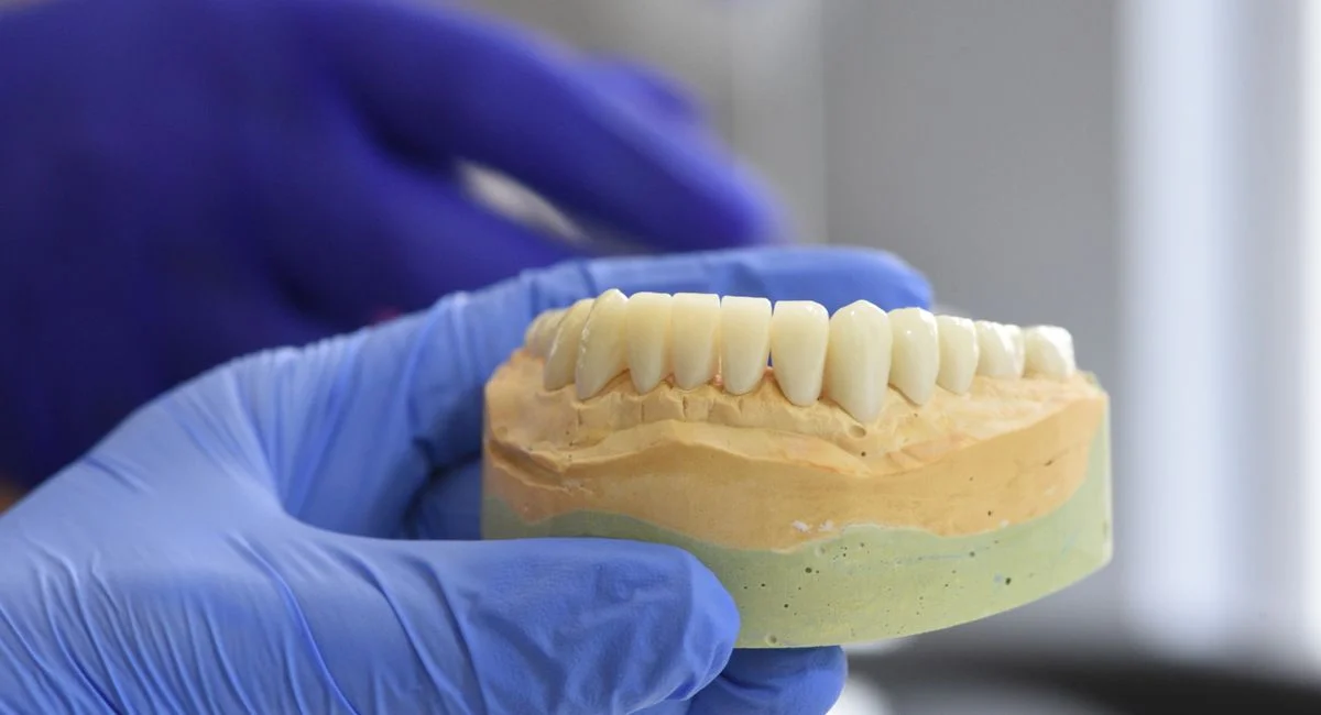 Close-up of a dental model held by gloved hands in a laboratory setting.