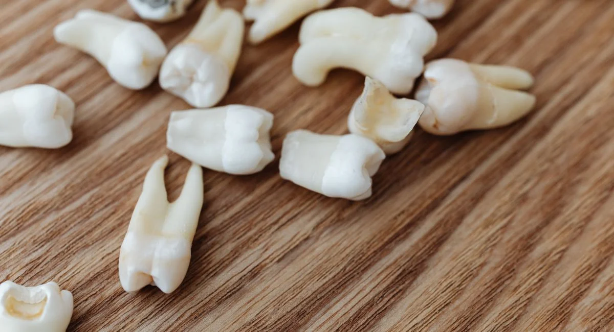 A detailed close-up of multiple extracted human teeth arranged on a wooden background surface.