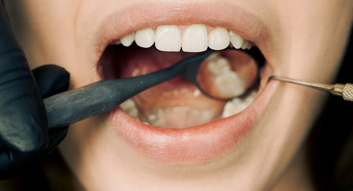 Close-up of a dental examination with modern equipment, showcasing oral hygiene maintenance.