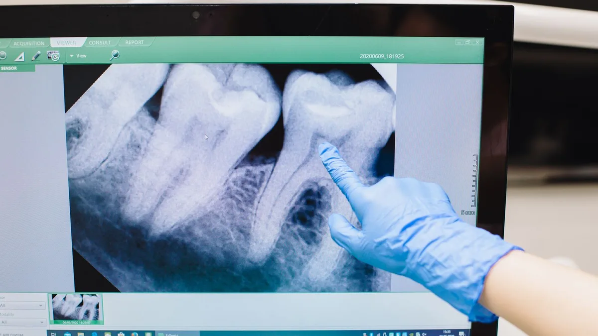 Une main gantée désigne une dent sur une radiographie affichée à l’écran