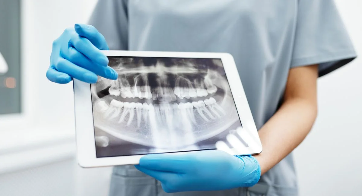 Dentist displaying a dental x-ray on a tablet for patient examination and diagnosis.