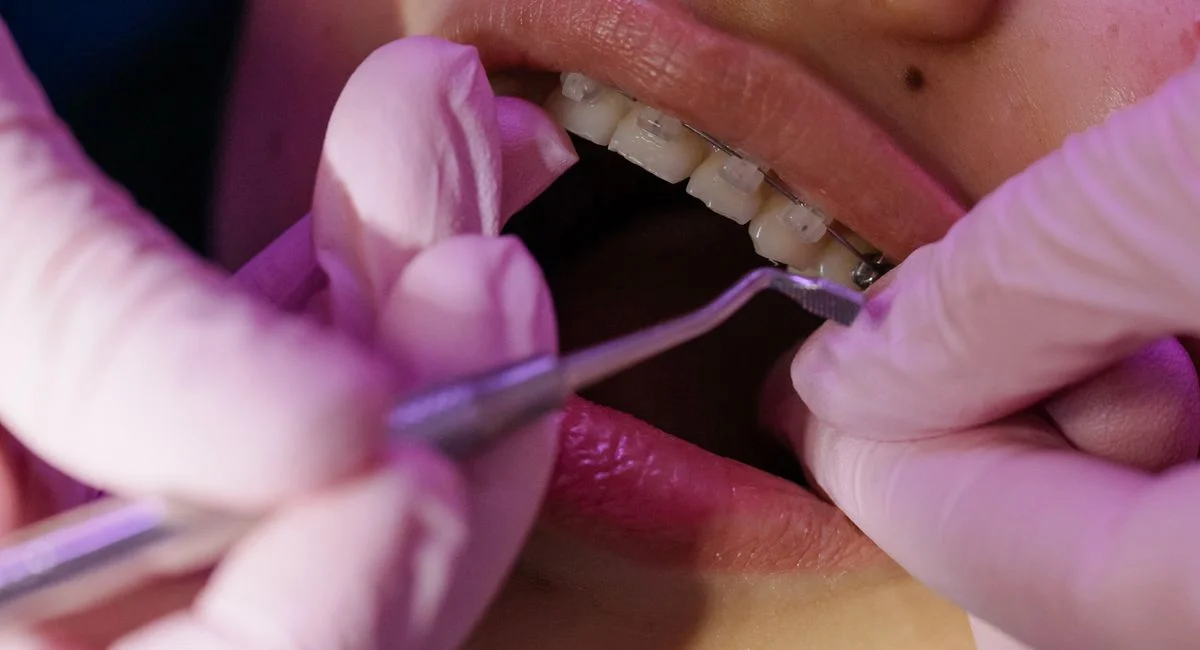 A dentist carefully examines orthodontic braces during a dental procedure.